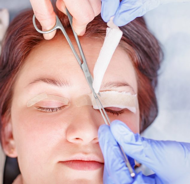 EYELID SURGERY in West Jordan Utah