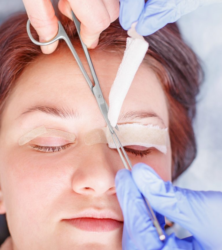 EYELID SURGERY in West Jordan Utah