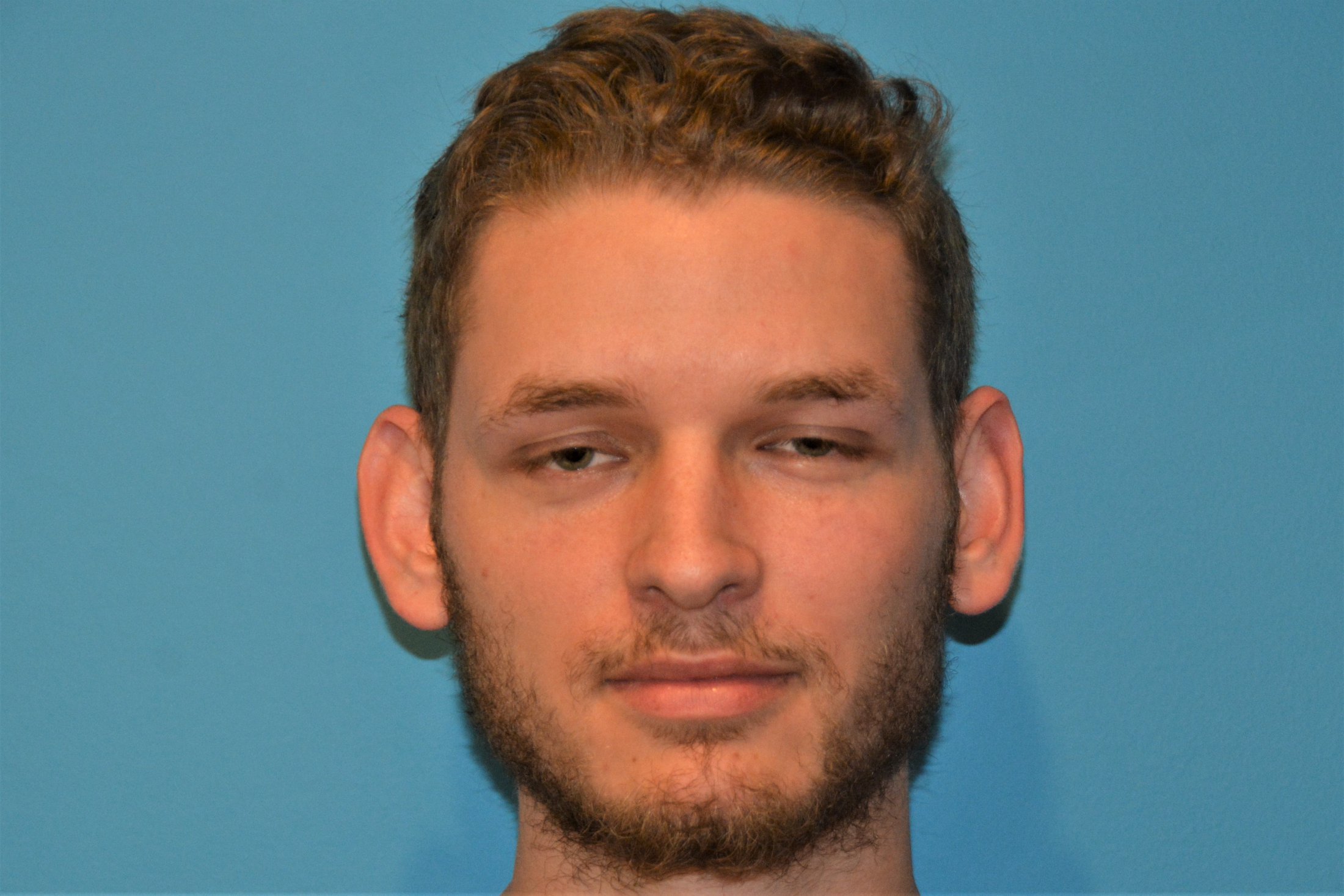 INJECTABLE FILLERS Before in West Jordan Utah