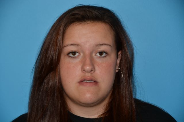 JAW SURGERY GALLERY BEFORE