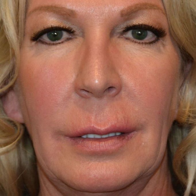 DSC_9006-1024×682-1-1-682×682