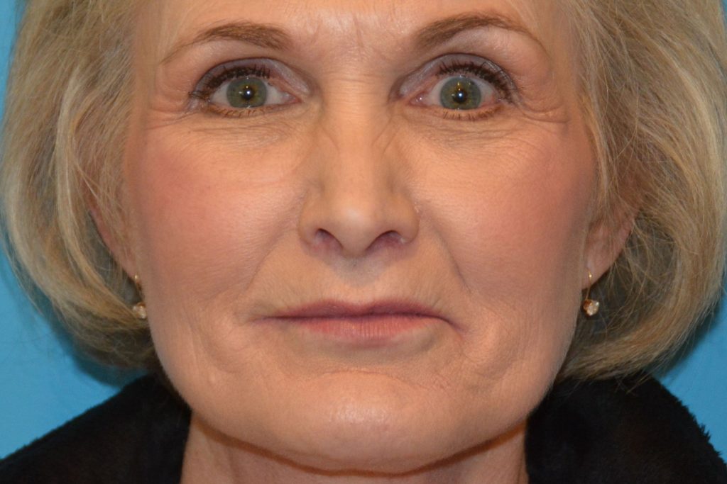 DSC_9328-1-1024×683