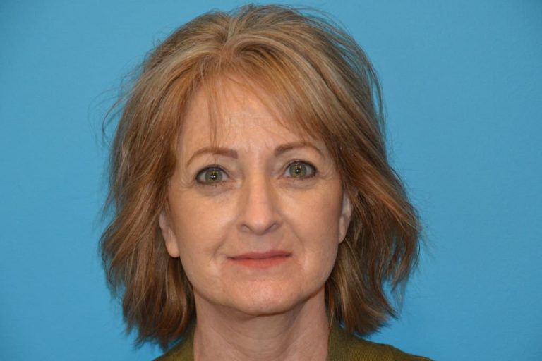 DSC_9391-1024×683-1-768×512