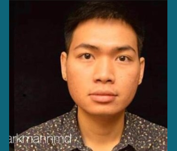 MORPHEUS8 RADIO FREQUENCY MICRONEEDLING after