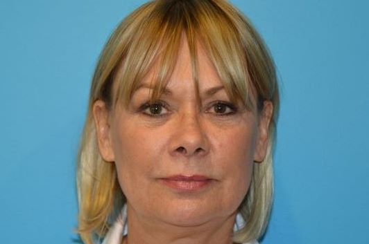 BEAUTIFY-LIFE LIFT GALLERY Before