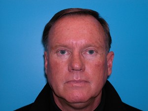 BEAUTIFY-LIFE LIFT GALLERY Before