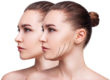 What Type Of Mini Face Lift Can Be Done To Raise Cheekbone
